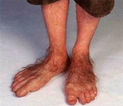 15-photos-des-pieds-les-plus-étranges-que-vous-allez-voir-de-votre-vie-la-dernière-est-à-vomir-14.jpg